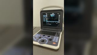 BR-US22 초음파 기계