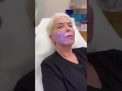 정확한 정맥 천자를 위한 QV 600 정맥 측정기