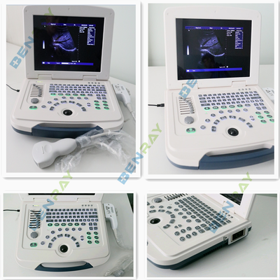 Full-digital laptop Ultrasound Diagnostic System 80element