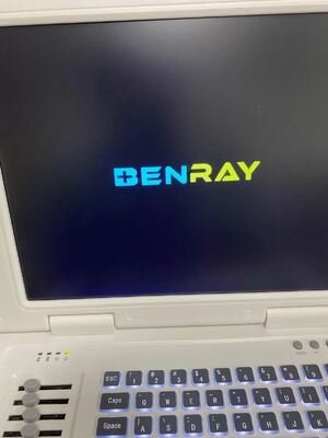 Full-digital laptop Ultrasound Diagnostic System 80element