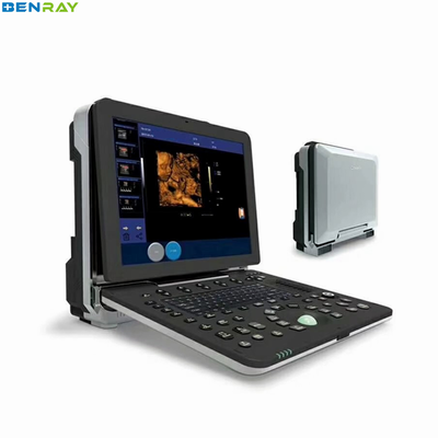 의료 초음파 장치 4D 휴대용 컬러 도플러 기계